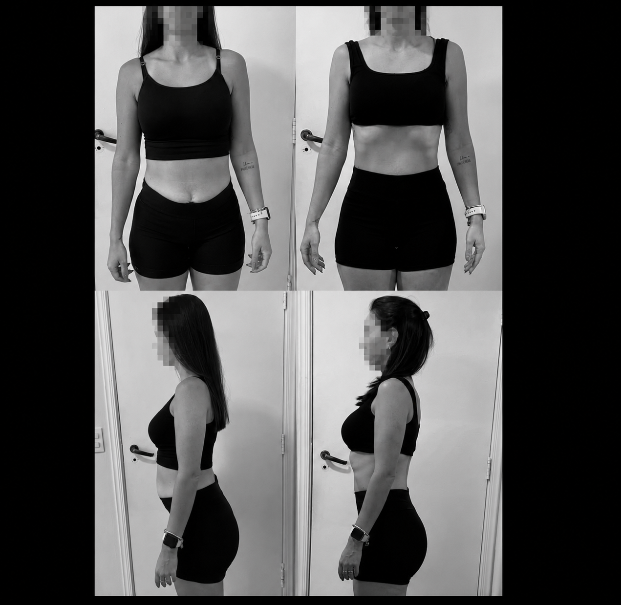 Resultado antes e depois de aluna do Zoncada Personal